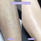 SilkGleam™ – Silky smooth skin, no bumps, no burns.