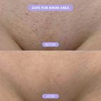SilkGleam™ – Silky smooth skin, no bumps, no burns.